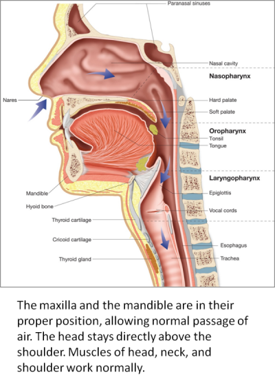 FamilyCare Dental – Airway Obstruction and Large Tongue